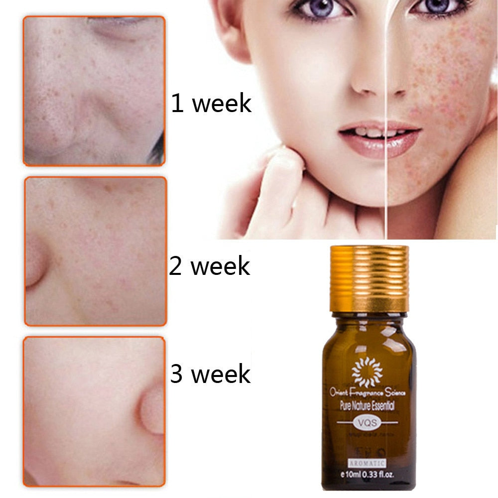 Dredge Meridian Skin Care Natural Pure Removal Acne Stretch Marks Scar Removal Essence oil null